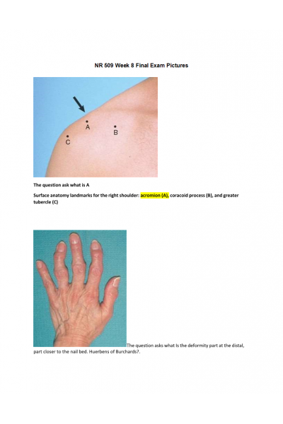 NR 509 Week 8 Final Exam Pictures
