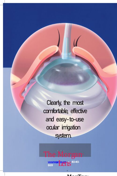 Morgan Lens; Clearly, the most comfortable, effective and easy-to-use ocular irrigation system